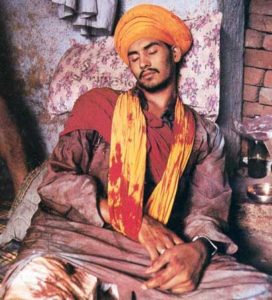 Operation Bluestar injured fighter